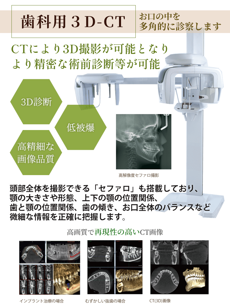 歯科用CT