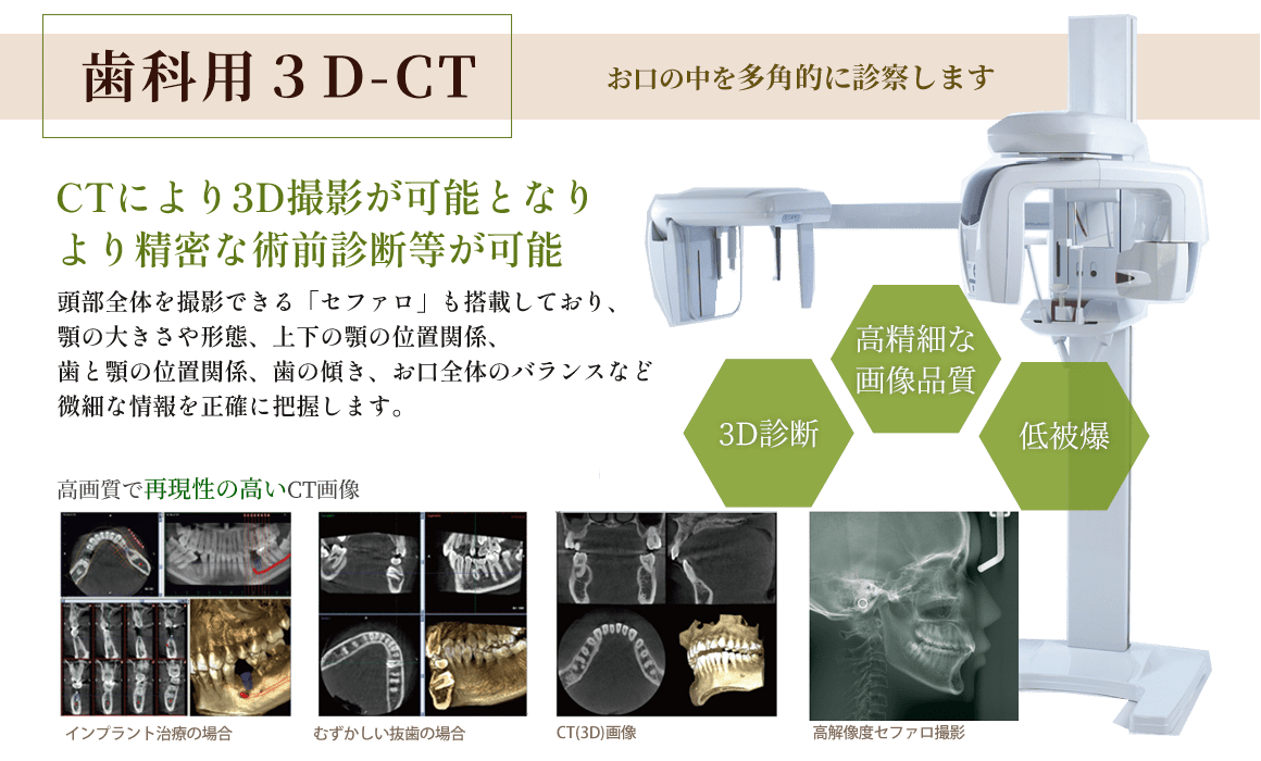 歯科用CT